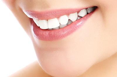 A close-up of a person s smiling face, showcasing teeth whitening results.