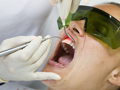 A person receiving dental treatment, with a dentist wearing protective eyewear and using dental instruments.